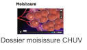 Dossier moisissure CHUV